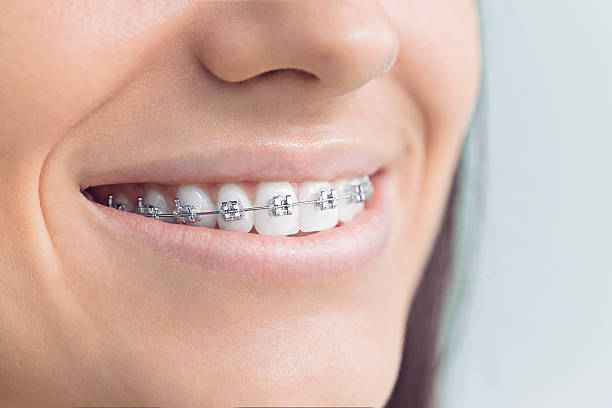 Best Full Mouth Reconstruction  in Ball, LA